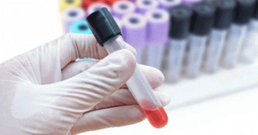 Kalsiyum Yüksekliği Nasıl Düşürülür?