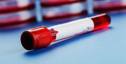 Kanda Kalsiyum Yüksekliği Belirtileri ve Tedavisi